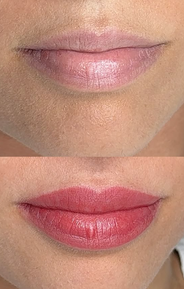 Antes y resultado recién realizado de micropigmentación de labios en Nohuska Granollers