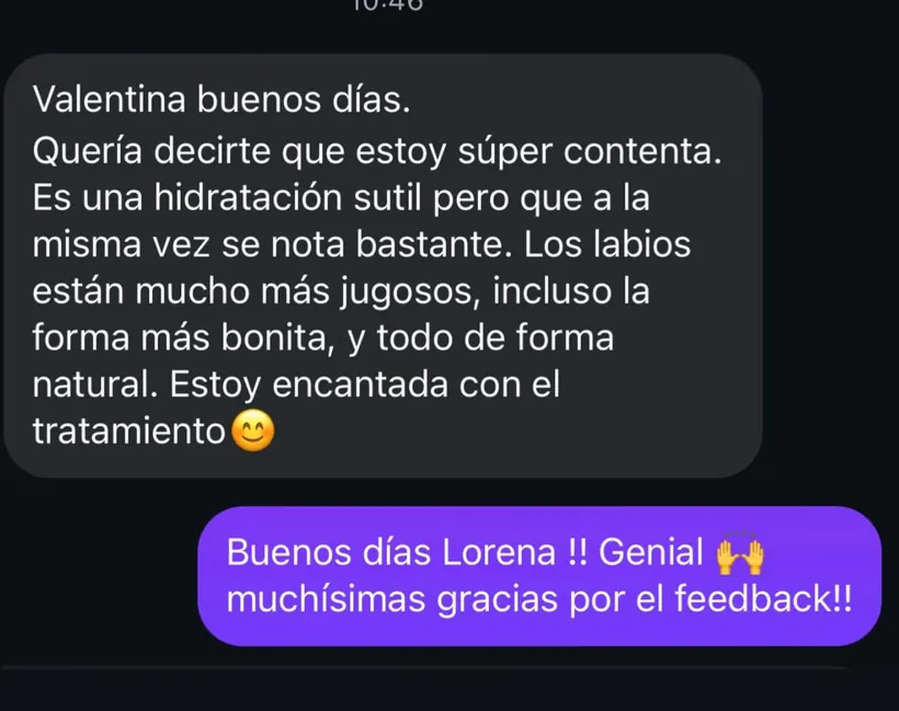 Captura de una opinión auténtica sobre el tratamiento Hydra Lips en Nohuska Beauty Lab